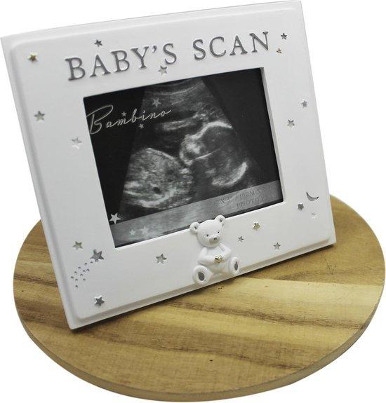 Babyscan_Fotolijst